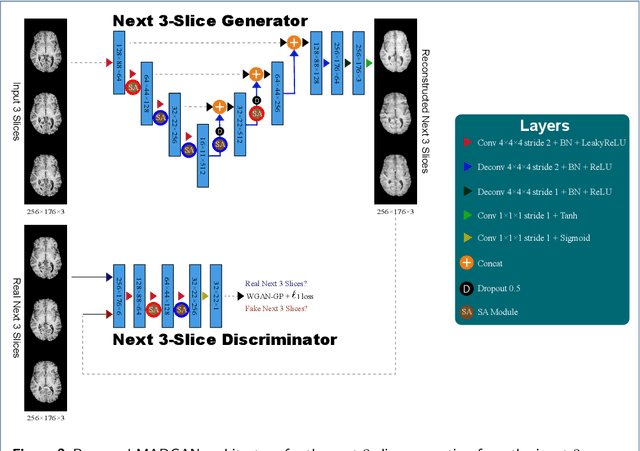 Figure 3 for MADGAN: unsupervised Medical Anomaly Detection GAN using multiple adjacent brain MRI slice reconstruction
