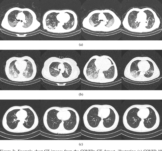 Figure 3 for COVIDNet-CT: A Tailored Deep Convolutional Neural Network Design for Detection of COVID-19 Cases from Chest CT Images