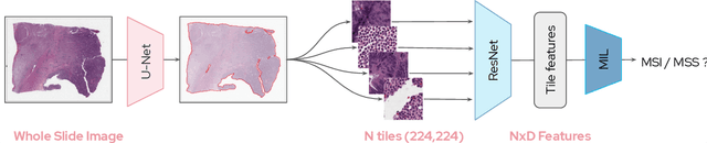 Figure 1 for Self supervised learning improves dMMR/MSI detection from histology slides across multiple cancers