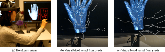 Figure 1 for Virtual Blood Vessels in Complex Background using Stereo X-ray Images