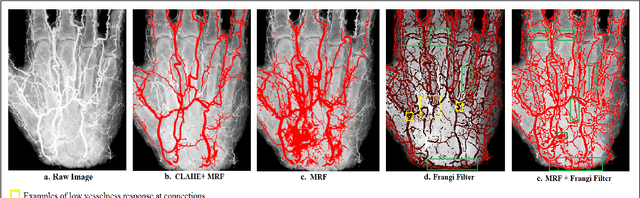 Figure 3 for Virtual Blood Vessels in Complex Background using Stereo X-ray Images