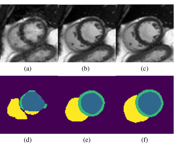 Figure 1 for Deep Learning Based Detection and Correction of Cardiac MR Motion Artefacts During Reconstruction for High-Quality Segmentation