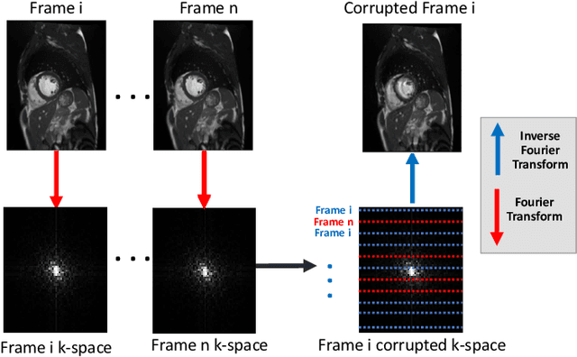 Figure 2 for Deep Learning Based Detection and Correction of Cardiac MR Motion Artefacts During Reconstruction for High-Quality Segmentation