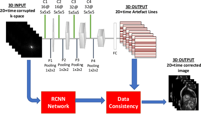 Figure 4 for Deep Learning Based Detection and Correction of Cardiac MR Motion Artefacts During Reconstruction for High-Quality Segmentation