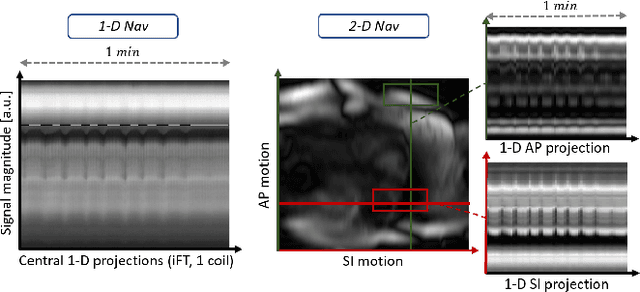 Figure 4 for 2-D Respiration Navigation Framework for 3-D Continuous Cardiac Magnetic Resonance Imaging