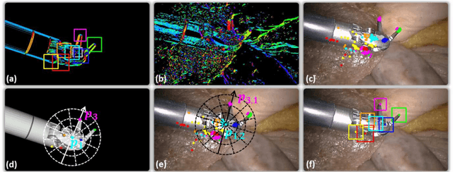 Figure 3 for Real-time 3D Tracking of Articulated Tools for Robotic Surgery