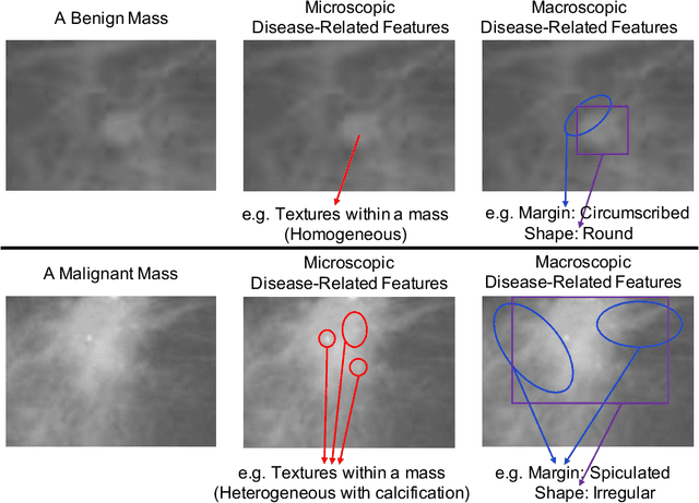 Figure 1 for Domain Invariant Model with Graph Convolutional Network for Mammogram Classification