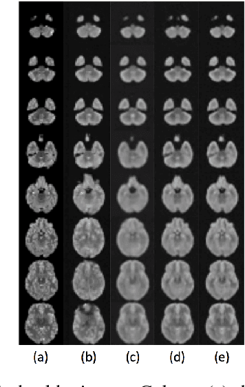 Figure 3 for Unsupervised Detection of Lesions in Brain MRI using constrained adversarial auto-encoders