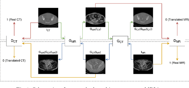 Figure 2 for Structurally aware bidirectional unpaired image to image translation between CT and MR
