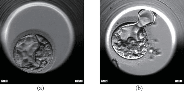Figure 1 for Image Segmentation of Zona-Ablated Human Blastocysts