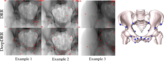 Figure 3 for DeepDRR -- A Catalyst for Machine Learning in Fluoroscopy-guided Procedures