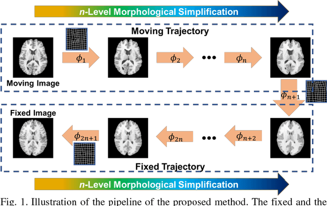 Figure 1 for Deep Morphological Simplification Network (MS-Net) for Guided Registration of Brain Magnetic Resonance Images