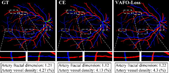 Figure 1 for VAFO-Loss: VAscular Feature Optimised Loss Function for Retinal Artery/Vein Segmentation