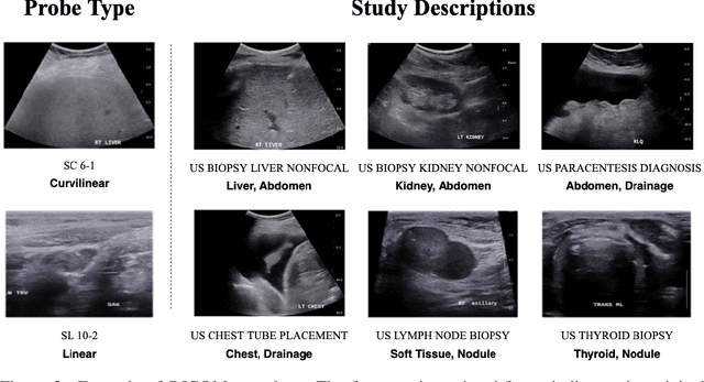 Figure 3 for Weakly Supervised Context Encoder using DICOM metadata in Ultrasound Imaging