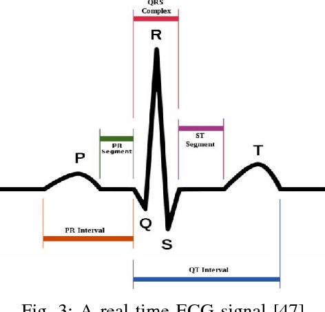 Figure 4 for Identifying the Mislabeled Training Samples of ECG Signals using Machine Learning