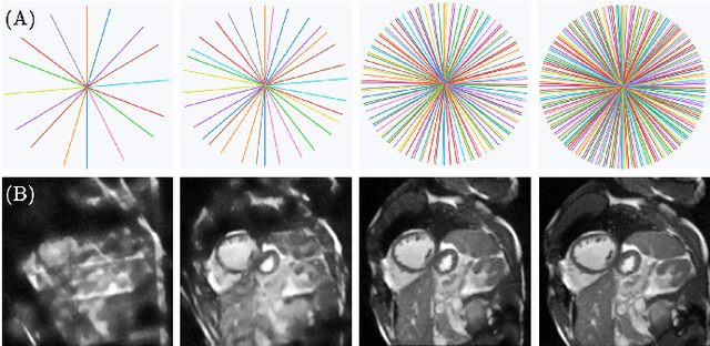 Figure 4 for A Deep Learning-based Integrated Framework for Quality-aware Undersampled Cine Cardiac MRI Reconstruction and Analysis
