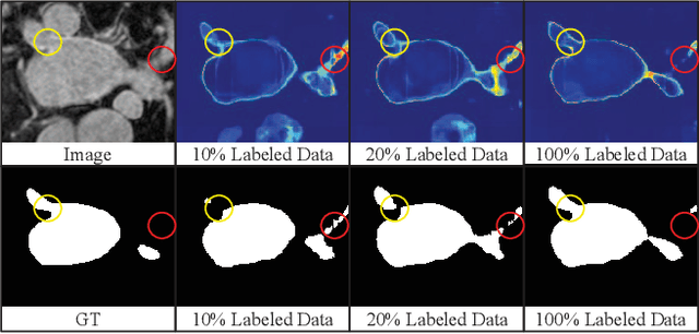 Figure 1 for Enforcing Mutual Consistency of Hard Regions for Semi-supervised Medical Image Segmentation