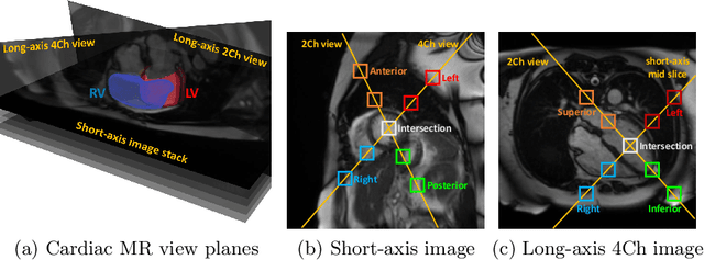 Figure 1 for Self-Supervised Learning for Cardiac MR Image Segmentation by Anatomical Position Prediction