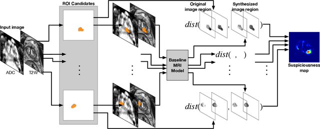 Figure 3 for Prostate cancer inference via weakly-supervised learning using a large collection of negative MRI