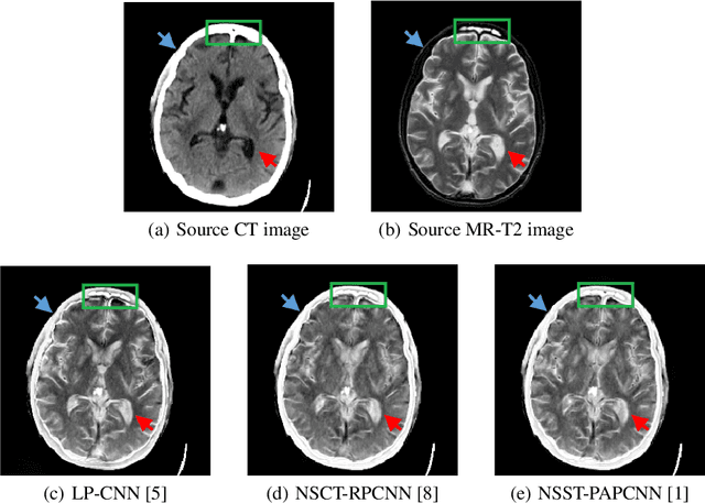 Figure 1 for A Semantic-based Medical Image Fusion Approach