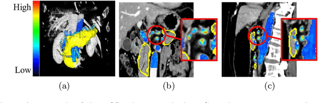 Figure 1 for Regression Forest-Based Atlas Localization and Direction Specific Atlas Generation for Pancreas Segmentation