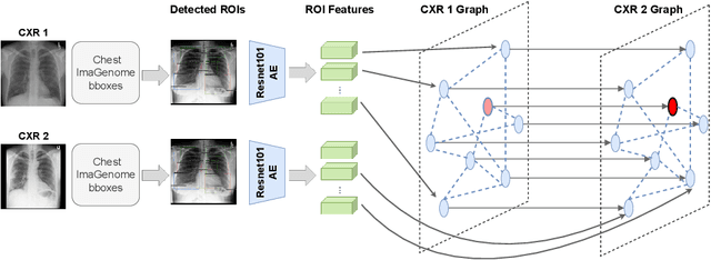 Figure 1 for CheXRelNet: An Anatomy-Aware Model for Tracking Longitudinal Relationships between Chest X-Rays