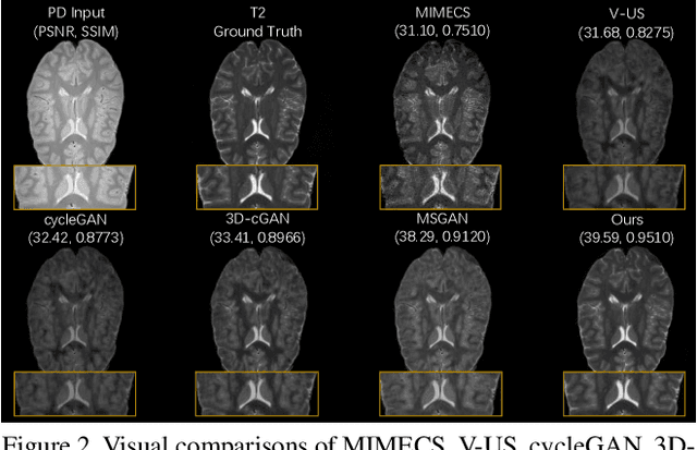Figure 3 for Brain Image Synthesis with Unsupervised Multivariate Canonical CSC$\ell_4$Net