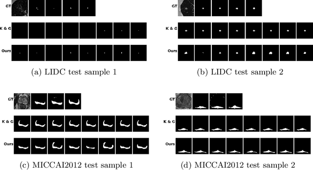 Figure 2 for Supervised Uncertainty Quantification for Segmentation with Multiple Annotations