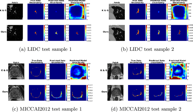 Figure 3 for Supervised Uncertainty Quantification for Segmentation with Multiple Annotations