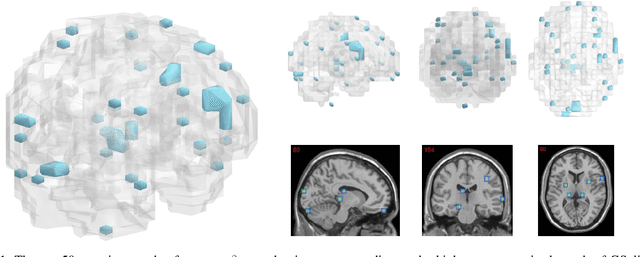 Figure 1 for Leveraging both Lesion Features and Procedural Bias in Neuroimaging: An Dual-Task Split dynamics of inverse scale space