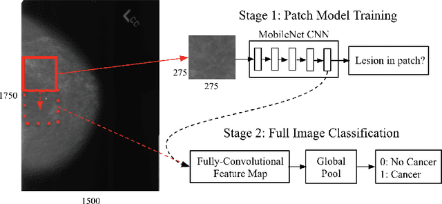 Figure 1 for Validation of a deep learning mammography model in a population with low screening rates