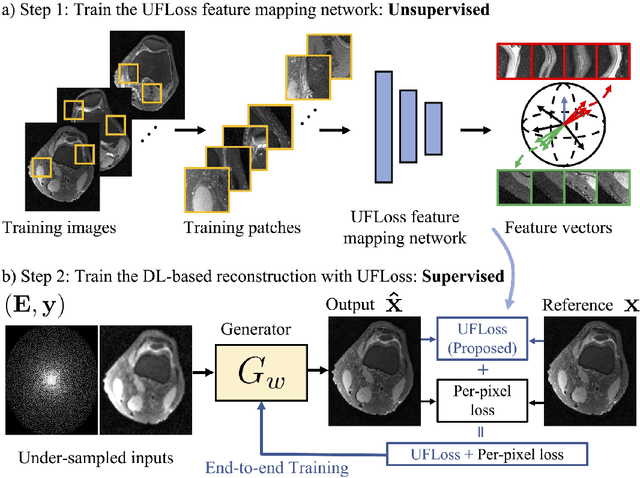 Figure 1 for High Fidelity Deep Learning-based MRI Reconstruction with Instance-wise Discriminative Feature Matching Loss