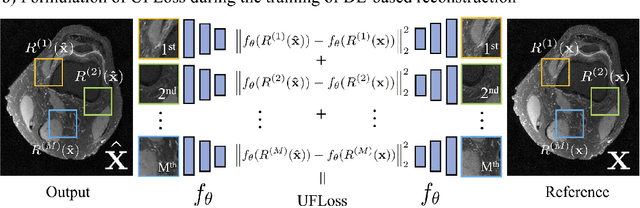 Figure 2 for High Fidelity Deep Learning-based MRI Reconstruction with Instance-wise Discriminative Feature Matching Loss