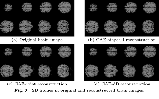 Figure 4 for Large-Scale Unsupervised Deep Representation Learning for Brain Structure