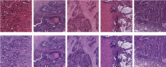 Figure 1 for The importance of stain normalization in colorectal tissue classification with convolutional networks