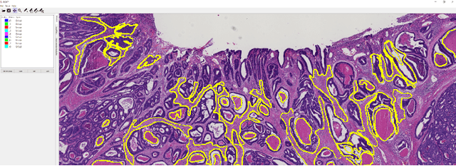 Figure 3 for The importance of stain normalization in colorectal tissue classification with convolutional networks