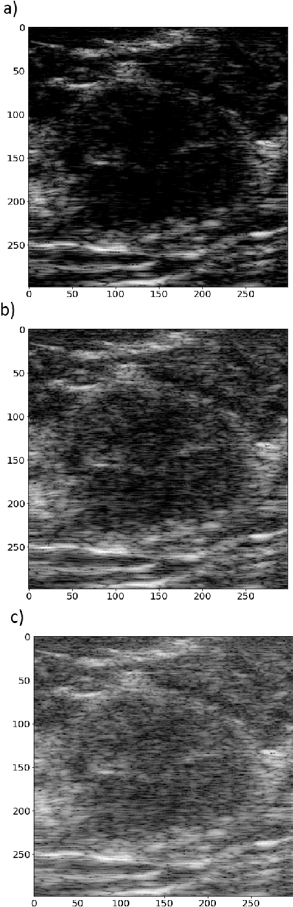 Figure 2 for Impact of ultrasound image reconstruction method on breast lesion classification with neural transfer learning