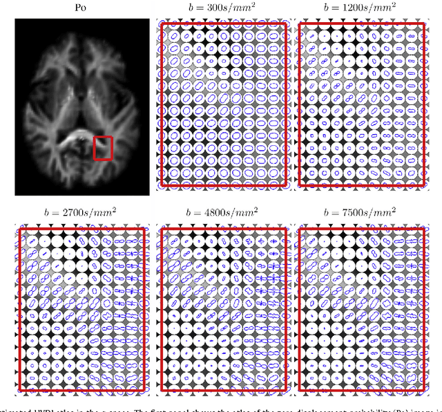 Figure 3 for Diffeomorphic Metric Mapping and Probabilistic Atlas Generation of Hybrid Diffusion Imaging based on BFOR Signal Basis
