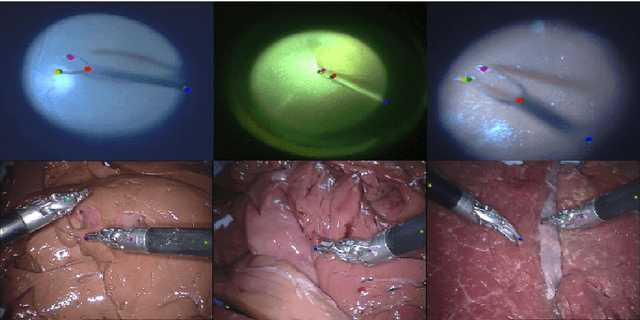 Figure 3 for Simultaneous Recognition and Pose Estimation of Instruments in Minimally Invasive Surgery