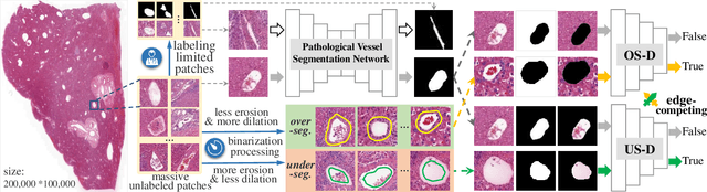 Figure 3 for Edge-competing Pathological Liver Vessel Segmentation with Limited Labels