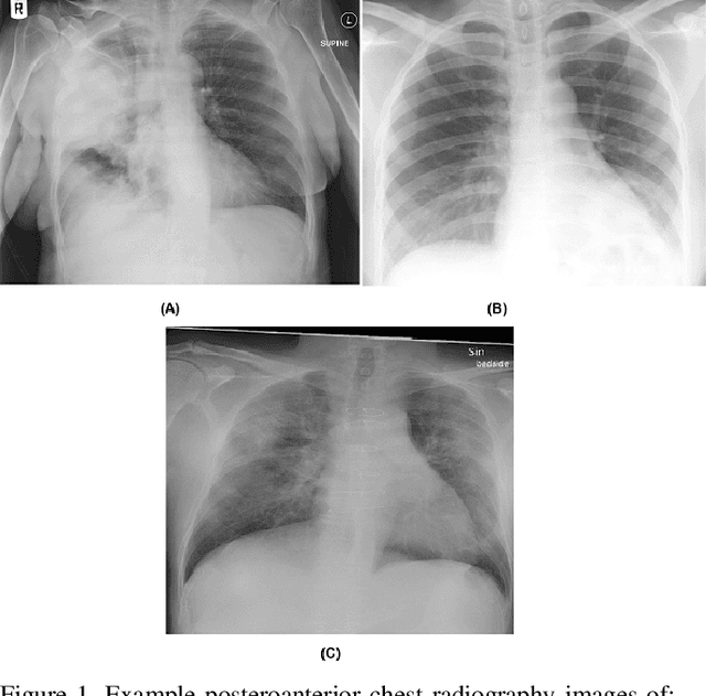 Figure 1 for COVID-Net: A Tailored Deep Convolutional Neural Network Design for Detection of COVID-19 Cases from Chest X-Ray Images