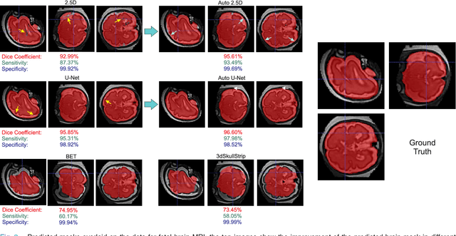 Figure 3 for Auto-context Convolutional Neural Network (Auto-Net) for Brain Extraction in Magnetic Resonance Imaging