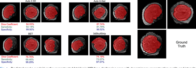 Figure 4 for Auto-context Convolutional Neural Network (Auto-Net) for Brain Extraction in Magnetic Resonance Imaging