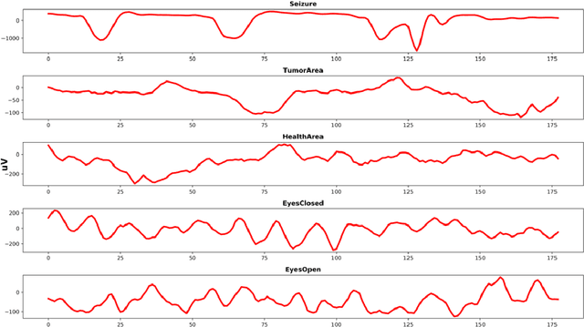 Figure 1 for Using Deep Learning and Machine Learning to Detect Epileptic Seizure with Electroencephalography (EEG) Data