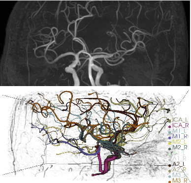 Figure 1 for Deep Feature Fusion via Graph Convolutional Network for Intracranial Artery Labeling