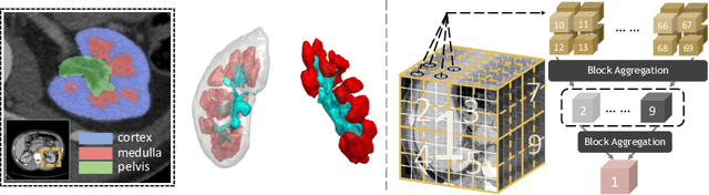 Figure 1 for Characterizing Renal Structures with 3D Block Aggregate Transformers