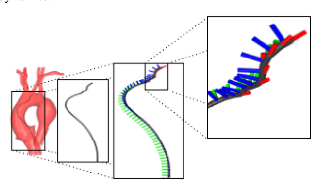 Figure 4 for CathSim: An Open-source Simulator for Autonomous Cannulation