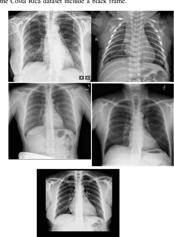 Figure 1 for Dealing with Distribution Mismatch in Semi-supervised Deep Learning for Covid-19 Detection Using Chest X-ray Images: A Novel Approach Using Feature Densities