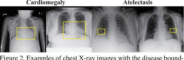 Figure 3 for Thoracic Disease Identification and Localization with Limited Supervision