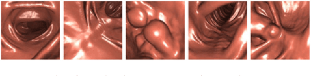 Figure 1 for Realistic Endoscopic Image Generation Method Using Virtual-to-real Image-domain Translation